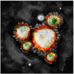 De la serie Microcosmos: “Corona solar”
